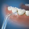 Bicos Jato Classic 2 Unidades Jt-100E Waterpik Original